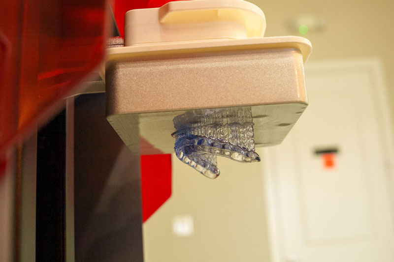 an invisalign machine that creates the retainer