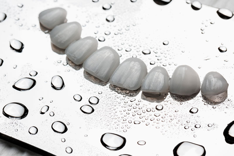 How Much Do Veneers Cost for Front Teeth? Your Comprehensive Guide to Pricing and Options